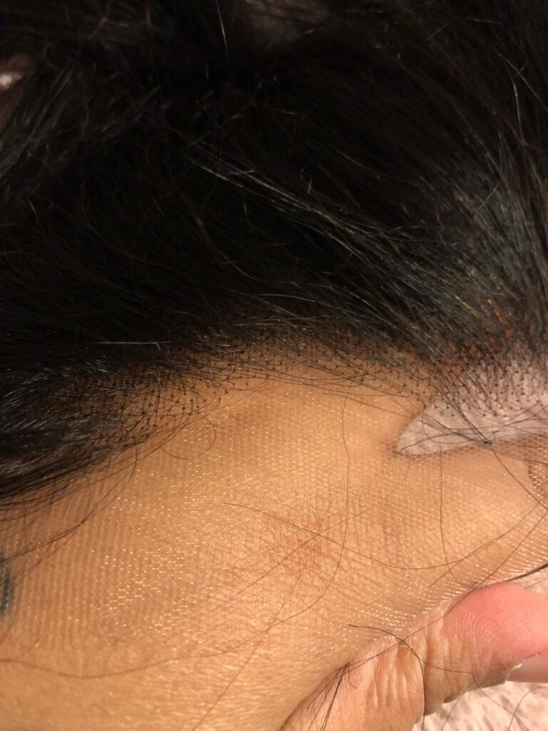 Virgin Human Hair Straight 13x4 13x6 HD Lace Frontal photo review